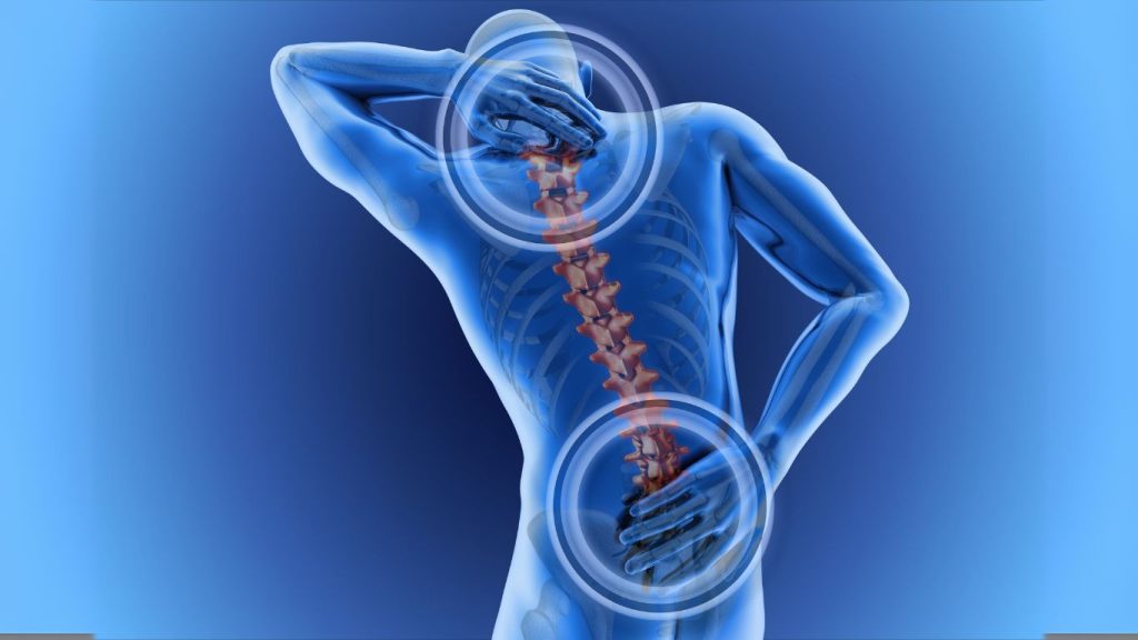 Cross-sectional illustration of the human spine highlighting areas of back pain, with a focus on decoding back pain.