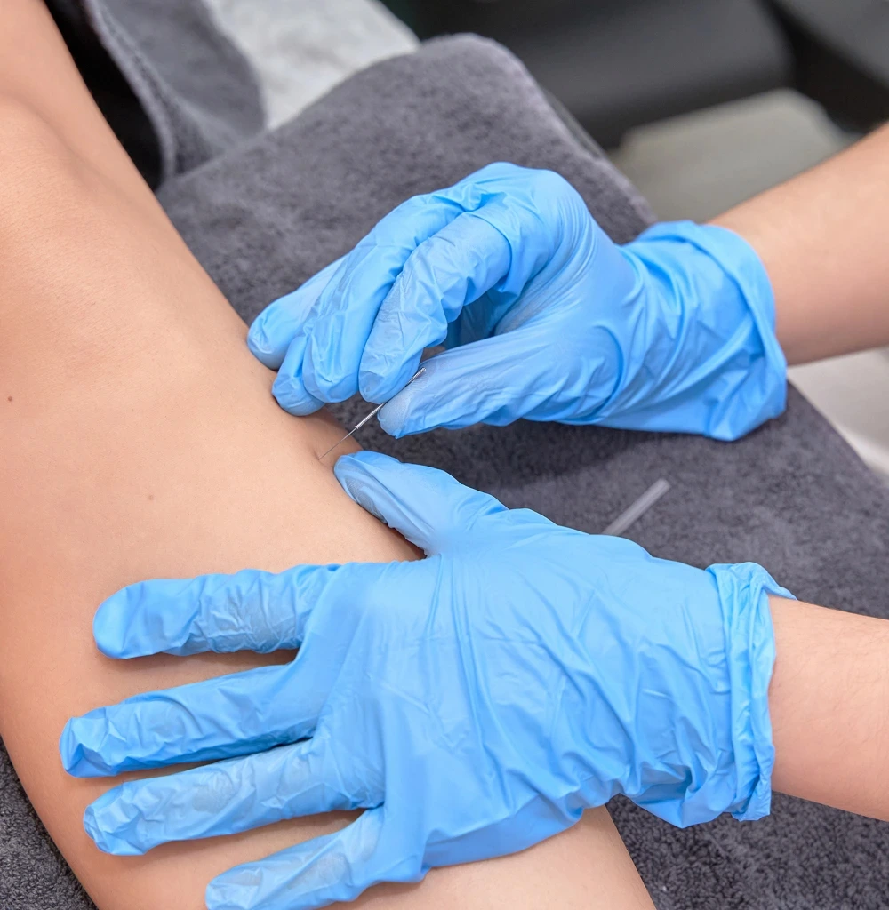 IMS Dry Needling Email LP 1 image 1